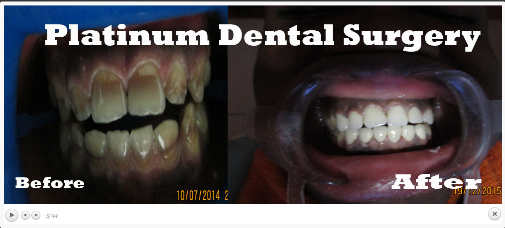 Platinum Dental Surgery - Award-Winning Dentist In Lagos Nigeria