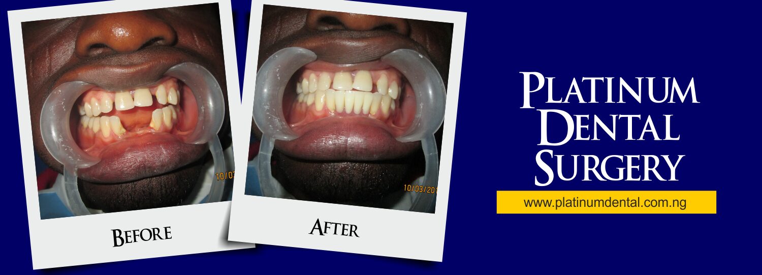 Smile Gallery Platinum Dental surgery (10)