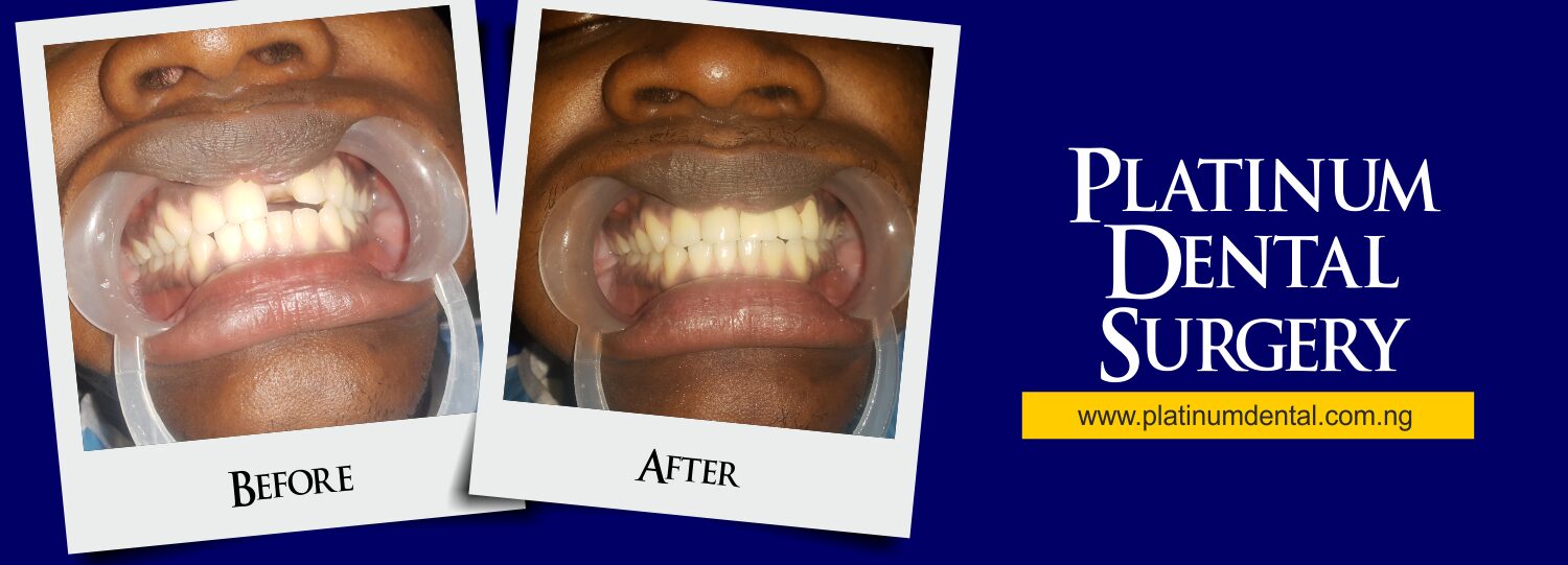 Smile Gallery Platinum Dental surgery (9)