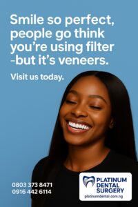dental veneers